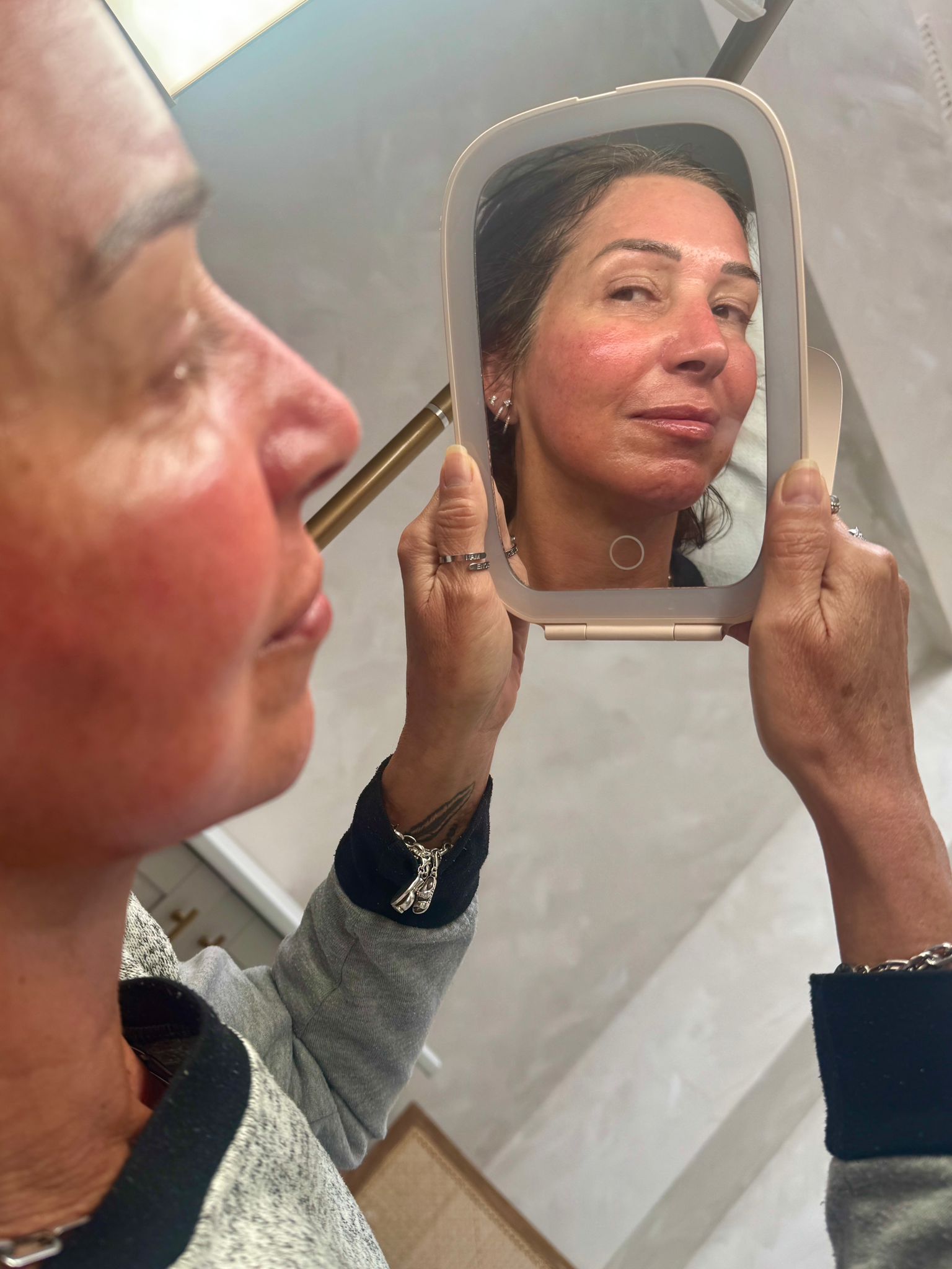 Microneedling facial treatment